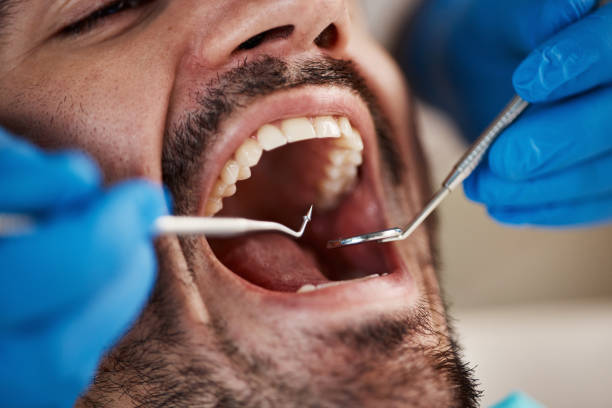 Best Emergency Dental Care for Sports Injuries in Boley, OK